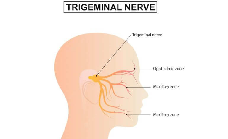 Nerve Entrapments